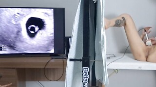 Cuckold takes wife to have an ultrasound!